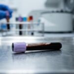 pruebas de laboratorio de esteroides